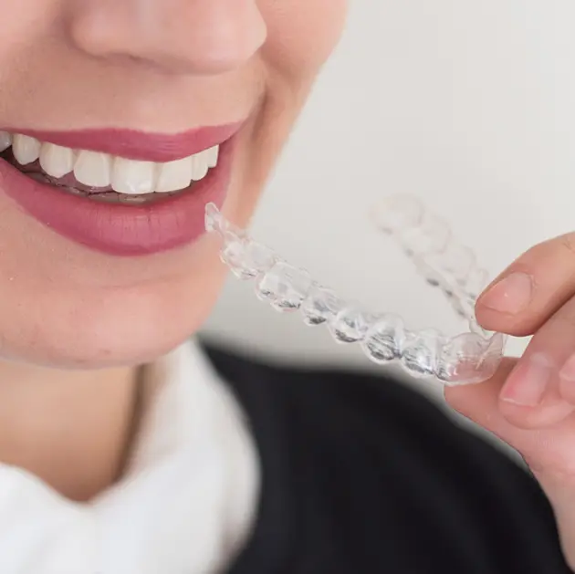 Keep smiling ortodoncia: la sonrisa perfecta al alcance de todos