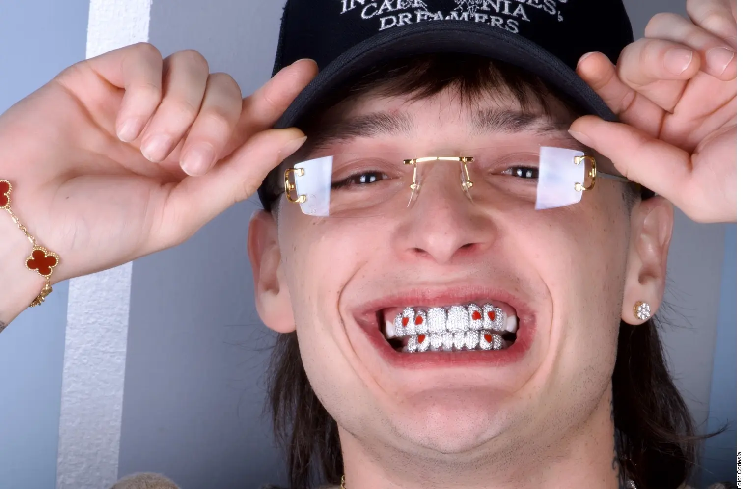 cuanto cuesta un diente de plata - Cómo se llaman los dientes de plata