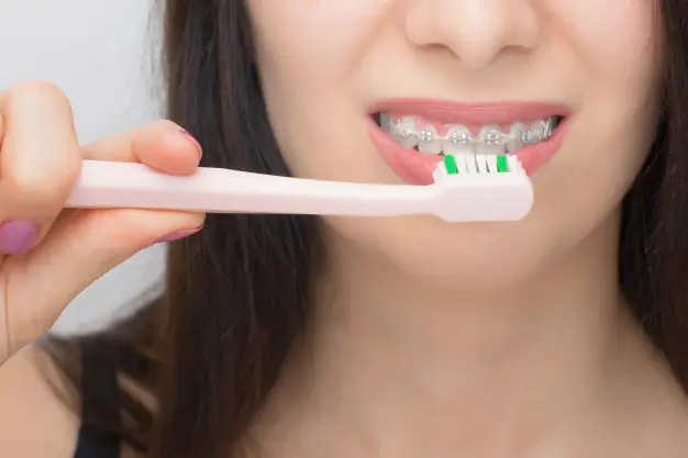 cepillo de dientes para brackets - Cómo se usa el cepillo de brackets