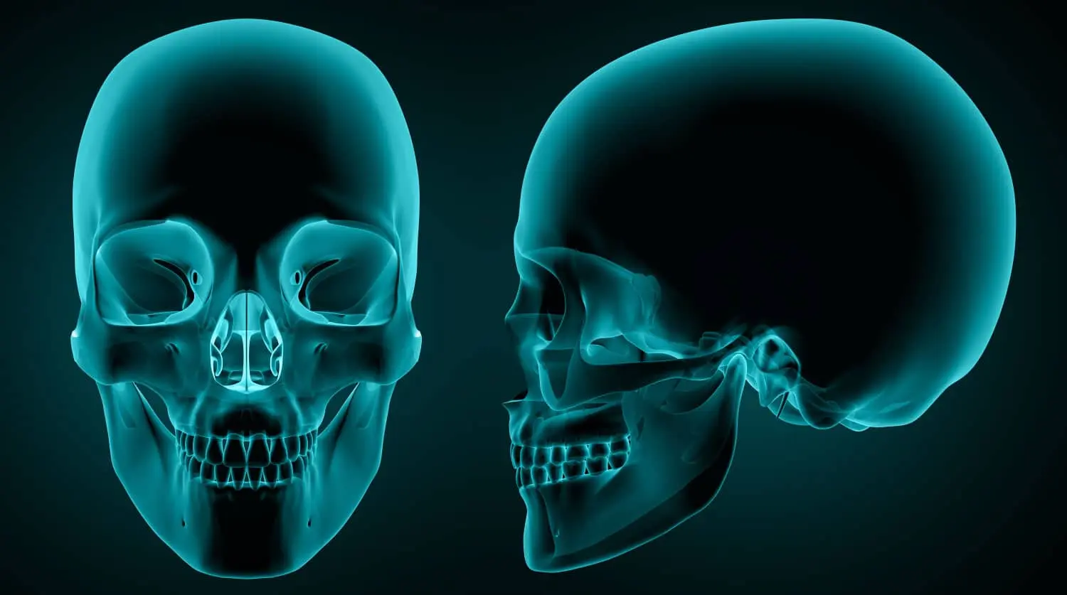 cirugia ortodoncia - Cuándo es necesaria una cirugía ortognática