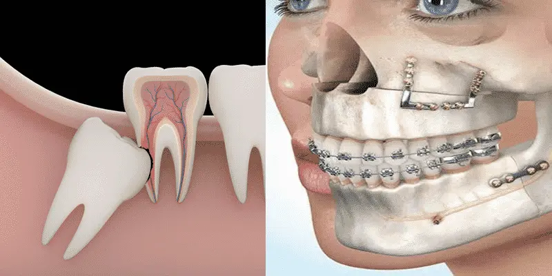 dentista maxilofacial - Cuánto cobra un maxilofacial por consulta