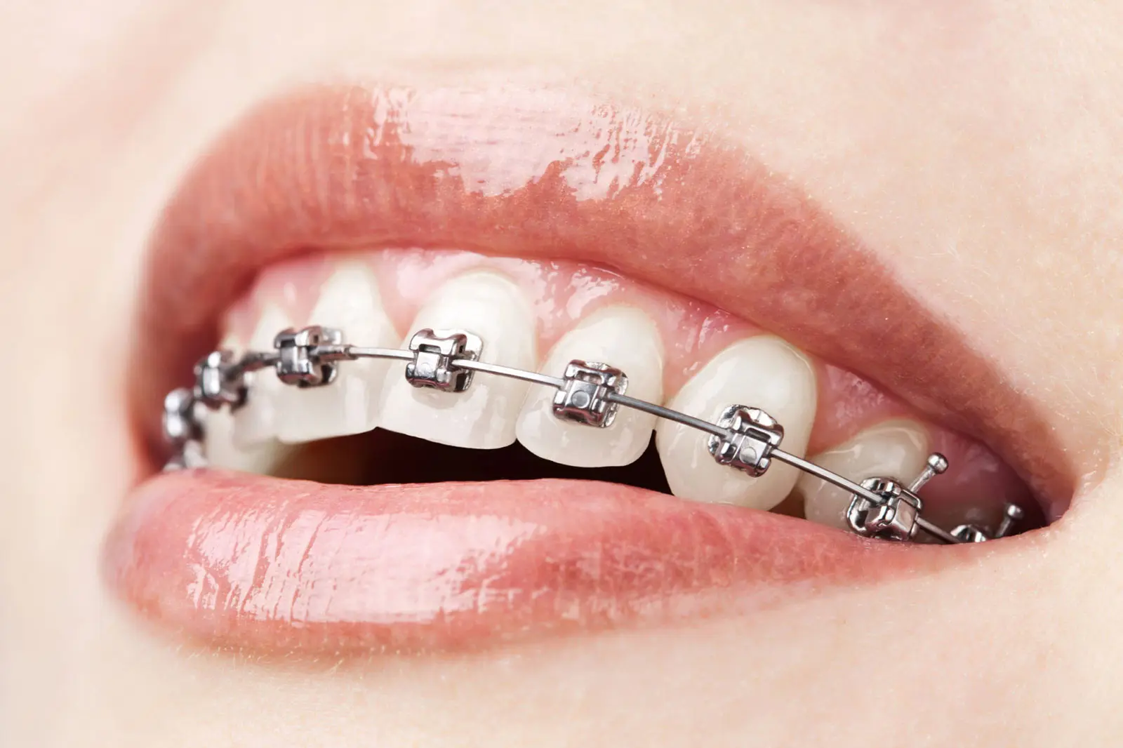 especialidad de ortodoncia en argentina - Cuántos años dura la especialidad de Ortodoncia