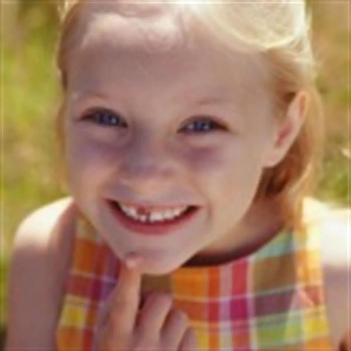dientes grises en niños - Qué es la fluorosis dental en niños